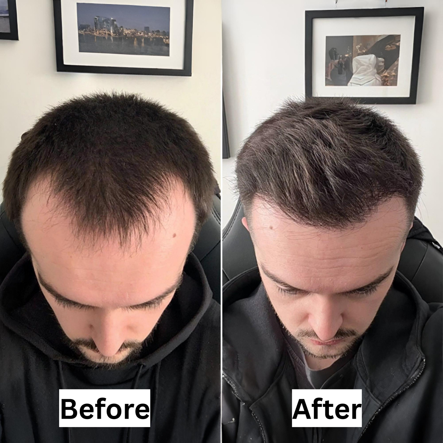 Revuro™ Advanced Growth Roll-On Serum