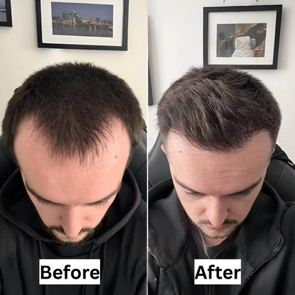 Revuro™ Advanced Growth Roll-On Serum