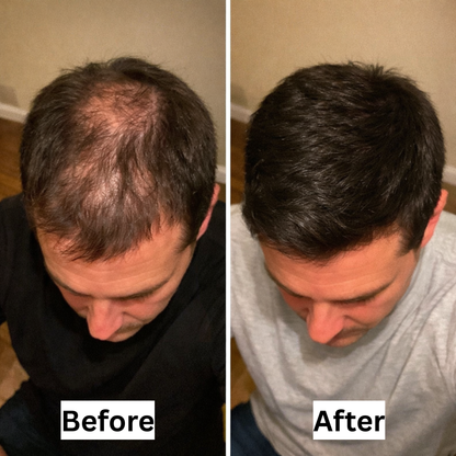 Revuro™ Advanced Growth Roll-On Serum